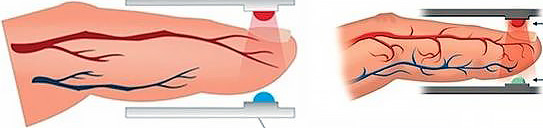 Как измеряется уровень кислорода в крови в умных часах